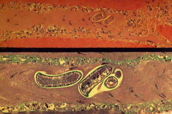 Larva no encapsulada de T. pseudospiralis en muestra de biopsia muscular de un paciente infectado el día 32 después de la infección (1).&nbsp;