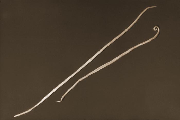 A. lumbricoides, hembra y macho. CDC Public Health Image Library (PHIL).
