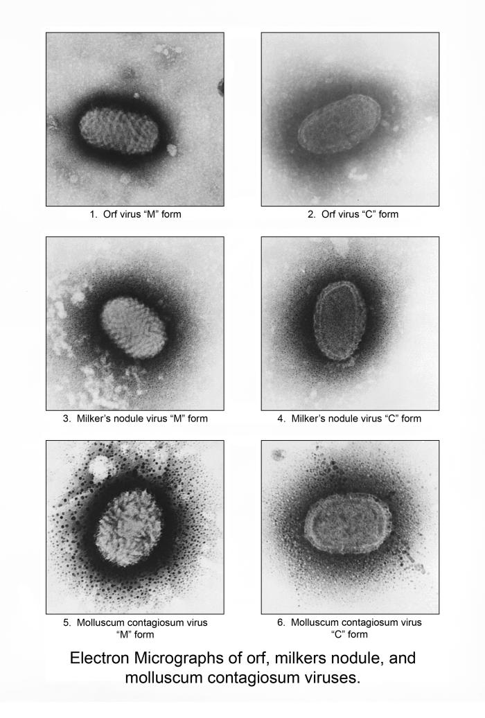 Virus del nódulo de los ordeñadores. CDC Public Health Image Library (PHIL).