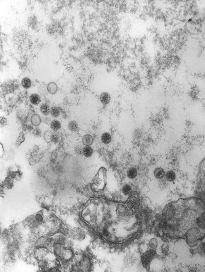 Epstein-Barr virus (EBV). CDC Public Health Image Library (PHIL).