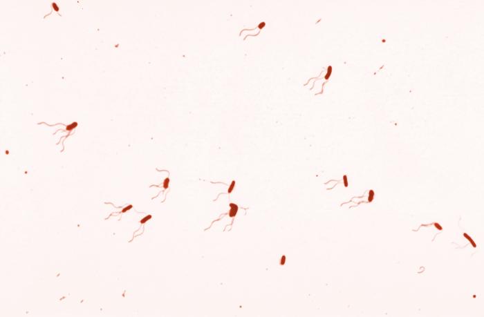 B. bronchiseptica. CDC Public Health Image Library (PHIL). 