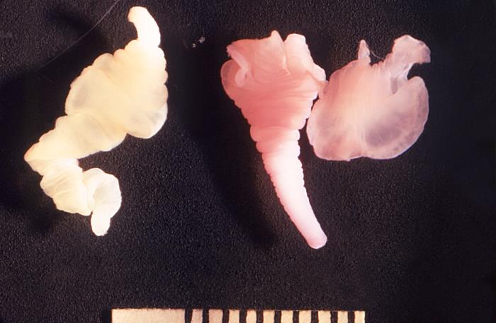 Cisticercos de T. solium. CDC Public Health Image Library (PHIL). 