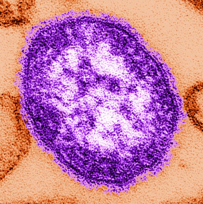 Virus del sarampión. CDC Public Health Image Library (PHIL).
