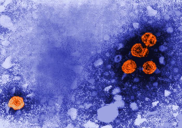 Virus de la hepatitis B. CDC Public Health Image Library (PHIL).