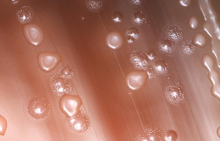 CDC Public Health Image Library (PHIL)