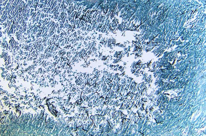 Cladophialophora bantiana. CDC Public Health Image Library (PHIL).           