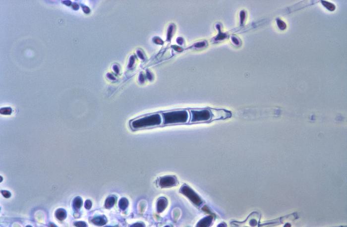 T. rubrum. CDC Public Health Image Library (PHIL).