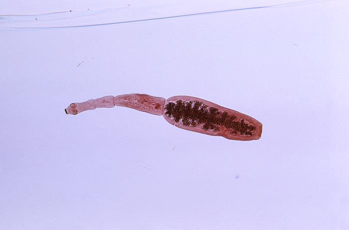 Adulto de Echinococcus granulosus. CDC Public Health Image Library (PHIL).