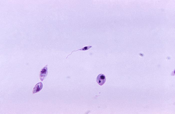 Promastigotes de Leishmania sp. CDC Public Health Image Library (PHIL).                  