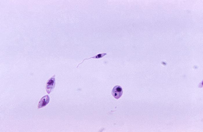 Promastigotes de Leishmania sp. CDC Public Health Image Library (PHIL). 