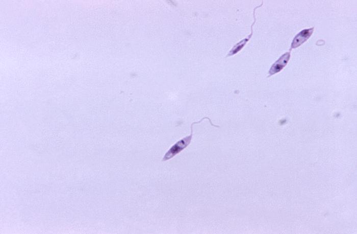 Promastigotes de Leishmania sp. CDC Public Health Image Library (PHIL).                        