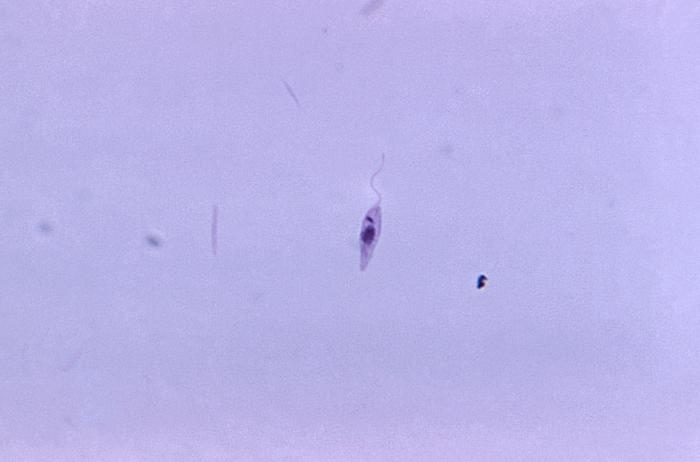 Leishmania sp. CDC Public Health Image Library (PHIL).