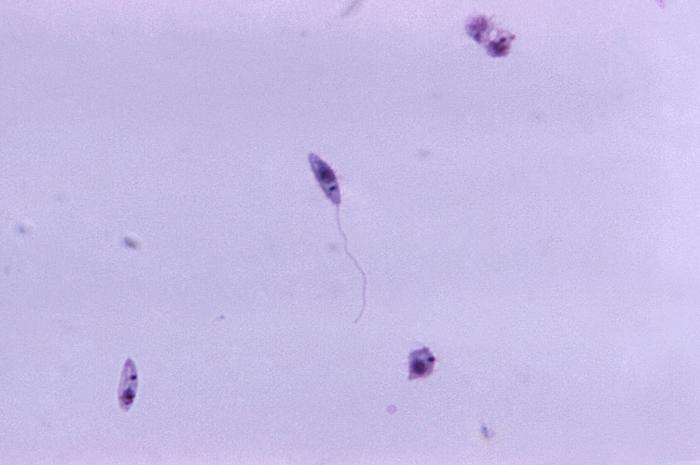 Promastigotes de Leishmania sp. CDC Public Health Image Library (PHIL).                             