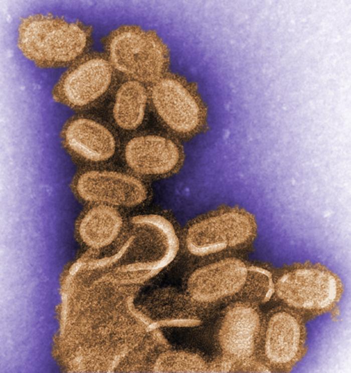 Viriones de Virus de la influenza. CDC Public Health Image Library (PHIL).              