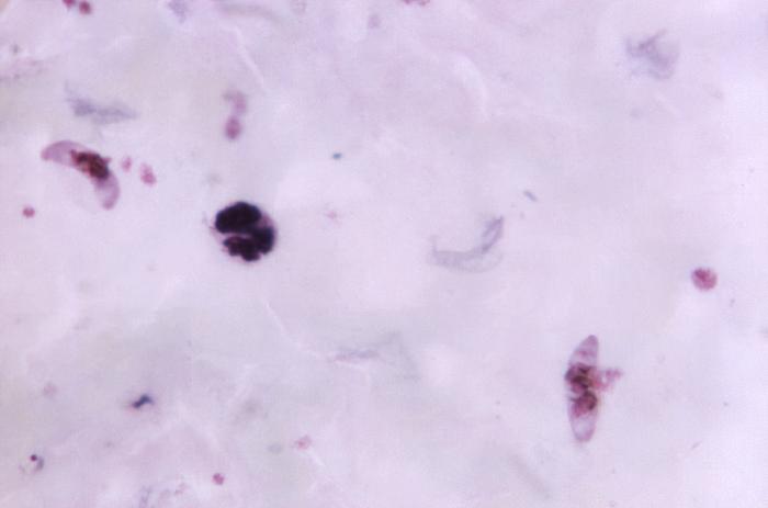 Gametocitos de Plasmodium falciparum. CDC Public Health Image Library (PHIL)