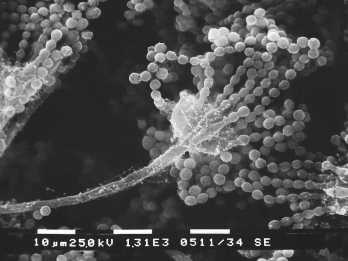 Aspergillus spp. CDC Public Health Image Library (PHIL).
