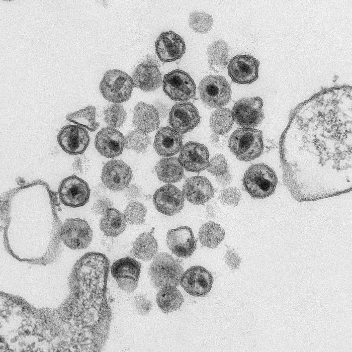 Virus de inmunodeficiencia humana .CDC Public Health Image Library (PHIL). 