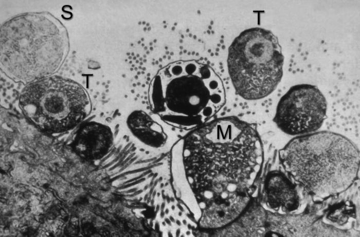 Esquizonte (S), trofozoítos (T) y microgameto (M) de Cryptosporidium sp. CDC Public Health Image Library (PHIL).