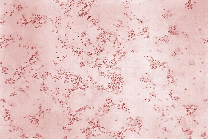 Fracncisella tularensis. CDC Public Health Image Library (PHIL).