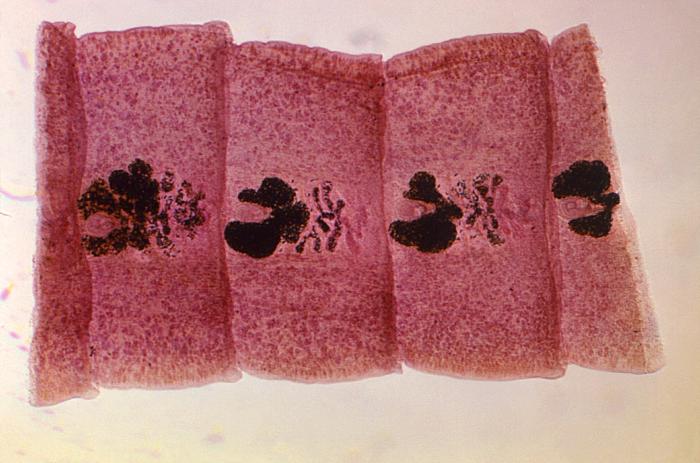 Proglótide grávida de D. latum. CDC Public Health Image Library (PHIL).