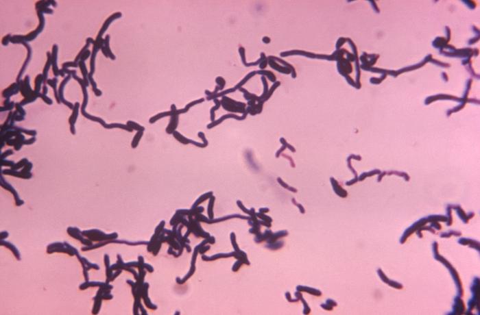 Corynebacterium matruchotii. CDC Public Health Image Library (PHIL).
