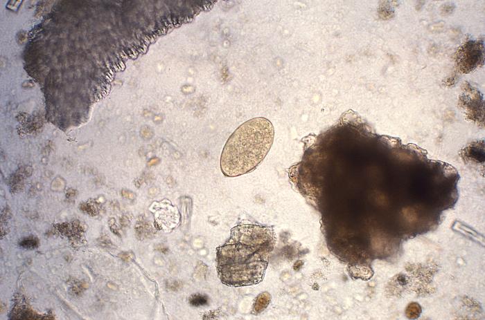 Ciclo de Fasciola hepatica. CDC Public Health Image Library (PHIL).