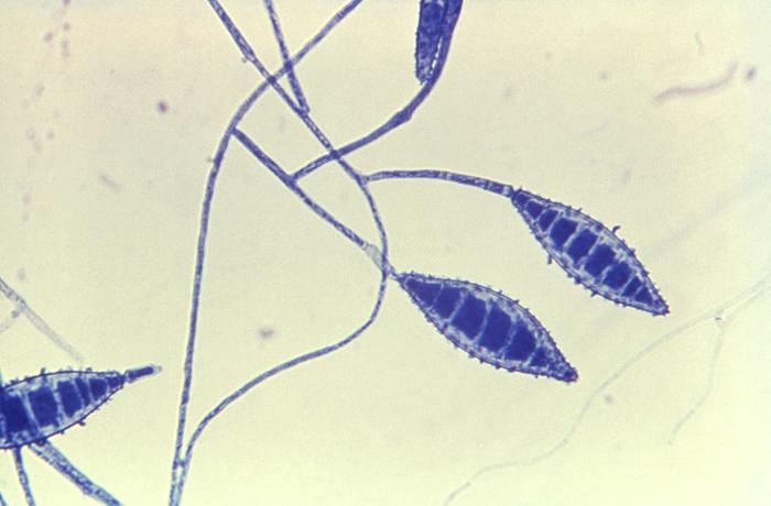 Macroconidios de M. canis. CDC Public Health Image Library (PHIL).