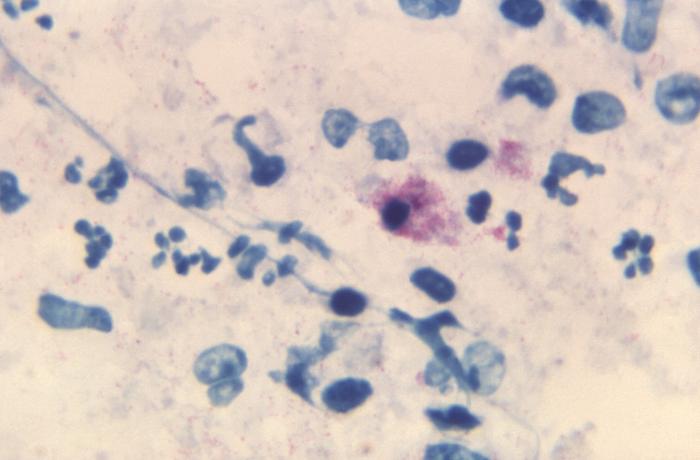 Chlamydophila psittaci. CDC Public Health Image Library (PHIL).Chlamydophila psittaci. CDC Public Health Image Library (PHIL).
