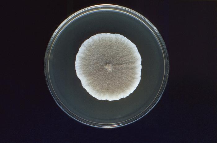 Colonia de Pseudallescheria boydii