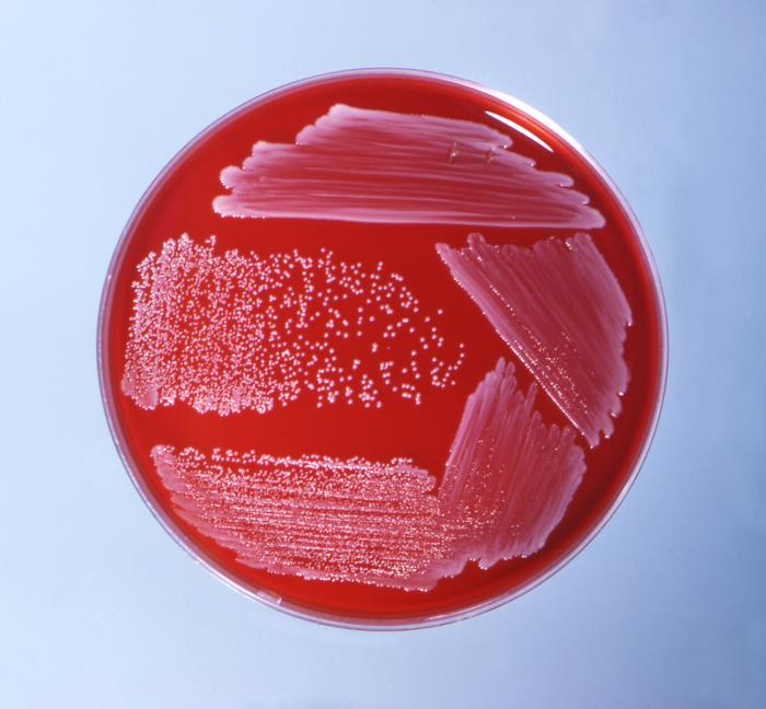 Colonias de C. ulcerans. CDC Public Health Image Library (PHIL).