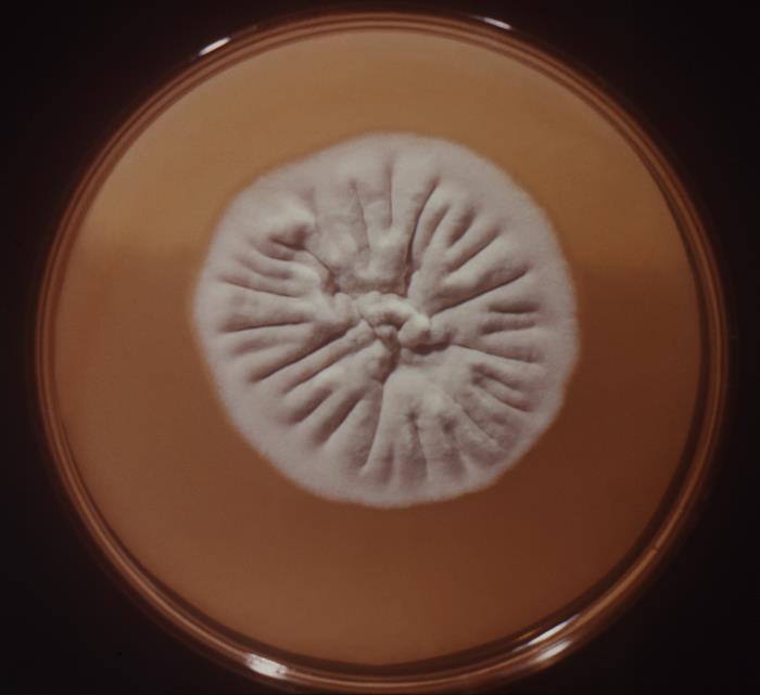 Colonia de T. rubrum. CDC Public Health Image Library (PHIL)