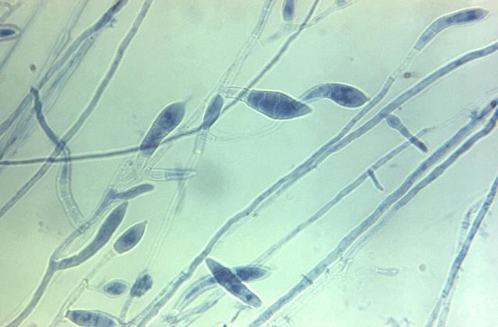 T. tonsurans. CDC Public Health Image Library (PHIL).