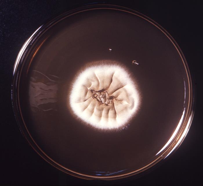 Colonia de T. tonsurans. CDC Public Health Image Library (PHIL).