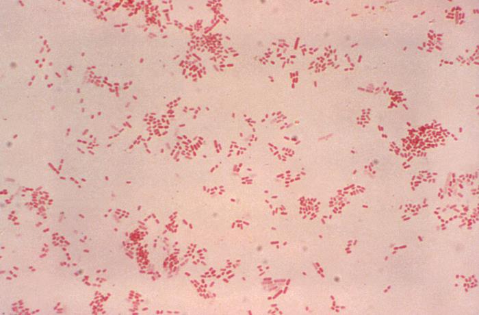 Pasteurella dagmatis. CDC Public Health Image Library (PHIL).