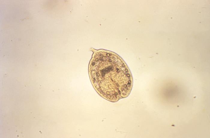 Protoescólices de Echinococcus spp. CDC Public Health Image Library (PHIL) 
