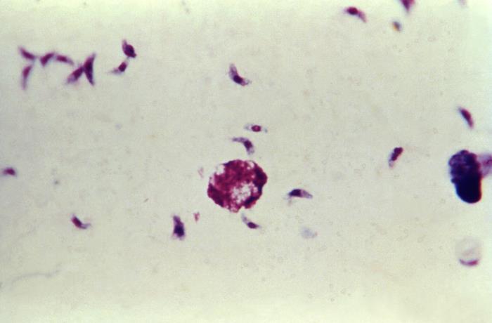 Taquizoitos de T. gondii. CDC Public Health Image Library (PHIL).