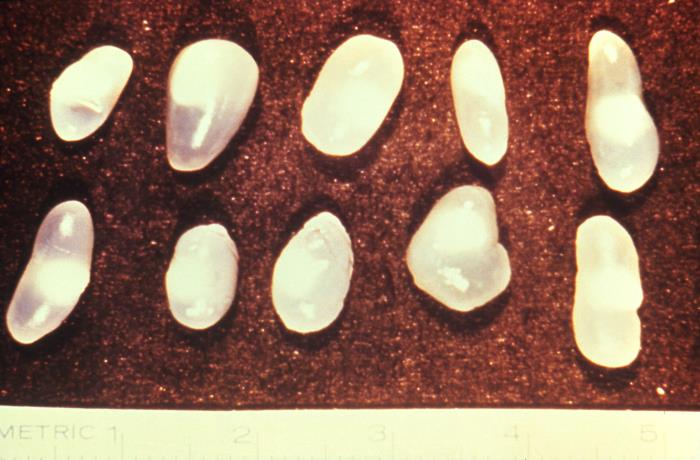 Cisticercos de T. solium. CDC Public Health Image Library (PHIL).