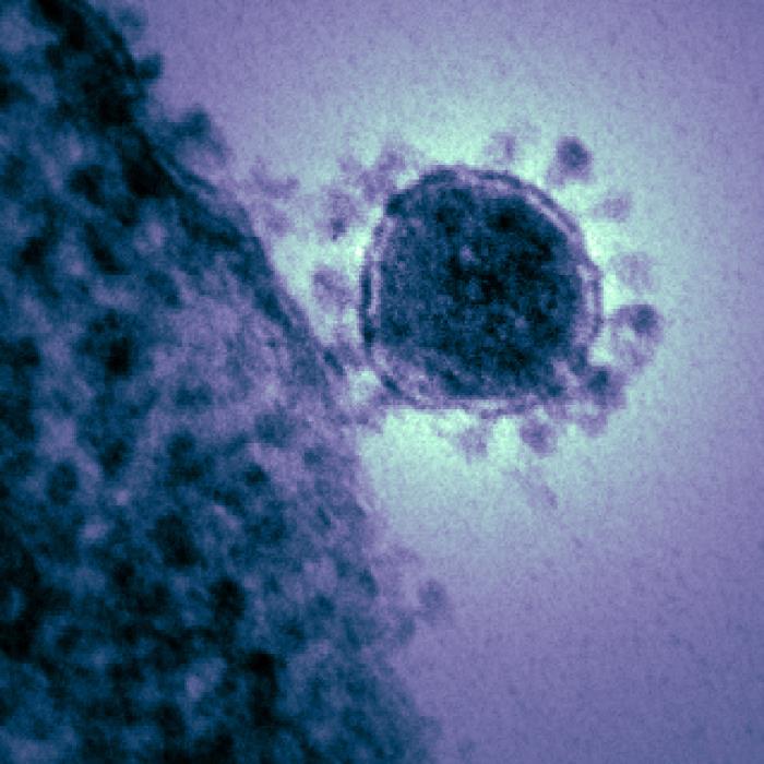 Virión del Coronavirus del síndrome respiratorio de Oriente Medio (MERS-CoV). CDC Public Health Image Library (PHIL).