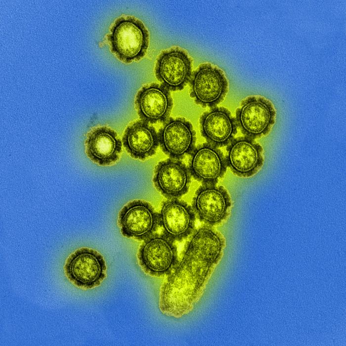 Virus de la influenza tipo A. CDC Public Health Image Library (PHIL).