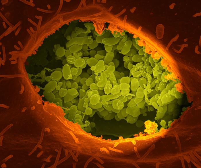 Coxiella burnetii en el interior de células VERO. CDC Public Health Image Library (PHIL).