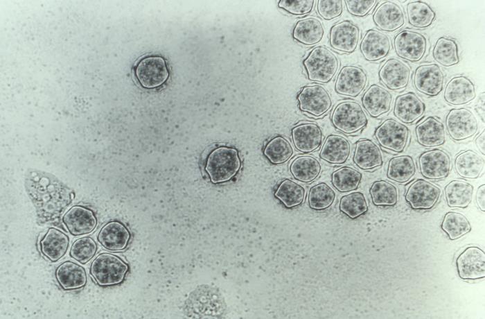 Quistes de Acanthamoeba sp. CDC Public Health Image Library (PHIL). 