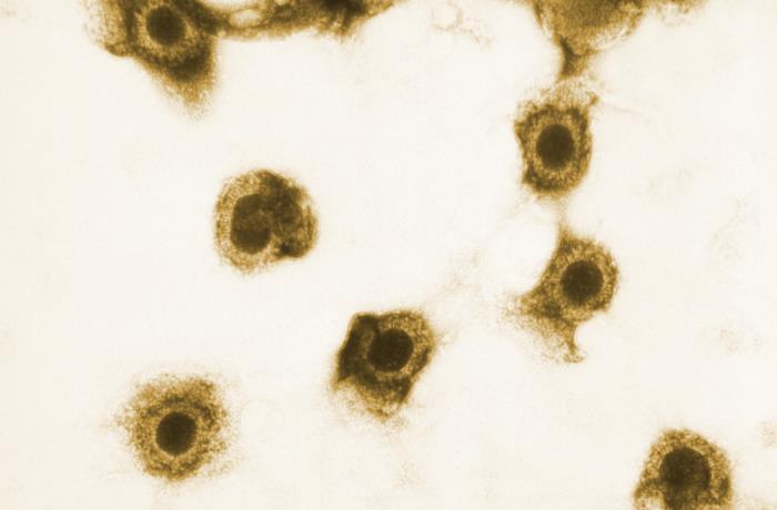 Citomegalovirus. CDC Public Health Image Library (PHIL).