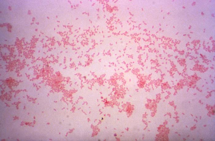 Cocobacilos de B. suis. CDC Public Health Image Library (PHIL).