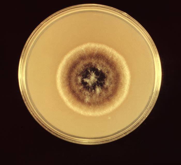 CDC Public Health Image Library (PHIL)