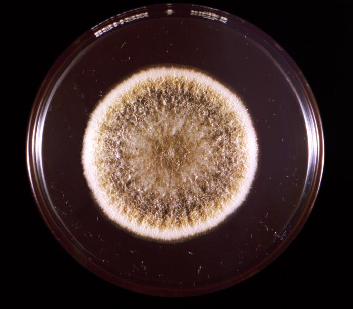 Colonia Aspergillus flavus. CDC Public Health Library (PHIL)