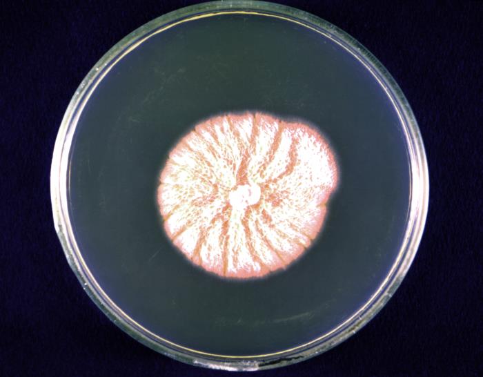 Colonia de Blastomyces dermatitidis. CDC Public Health Image Library (PHIL).Colonia de Blastomyces dermatitidis. CDC Public Health Image Library (PHIL).