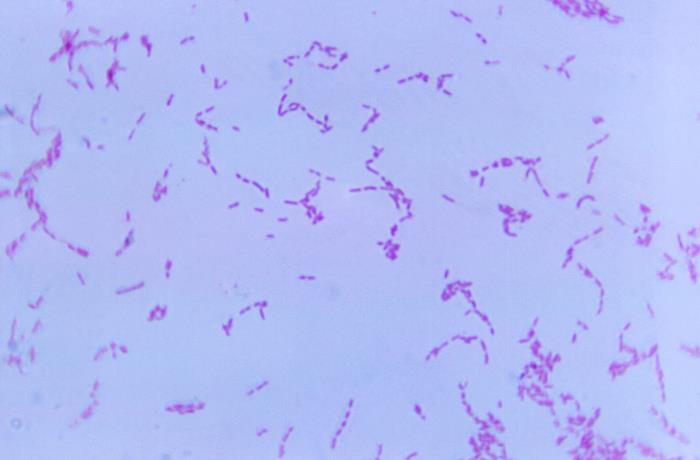 Erysipelothrix rhusiopathiae. CDC Public Health Library (PHIL).