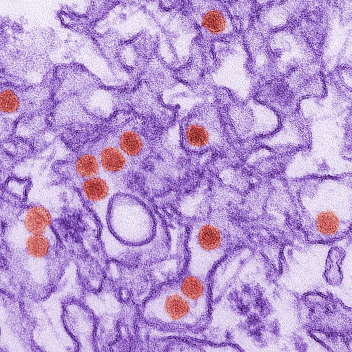 Viriones de Virus de Zika, coloreados en rojo. CDC Public Health Image Library (PHIL).
