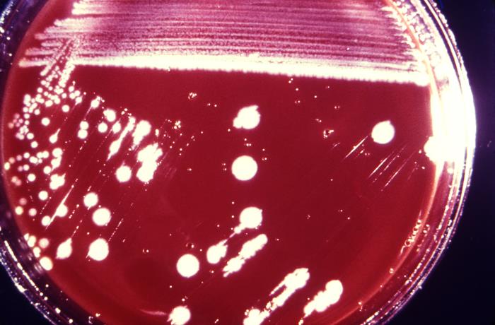 Colonias de Listeria monocytogenes. CDC Public Health Image Library (PHIL)