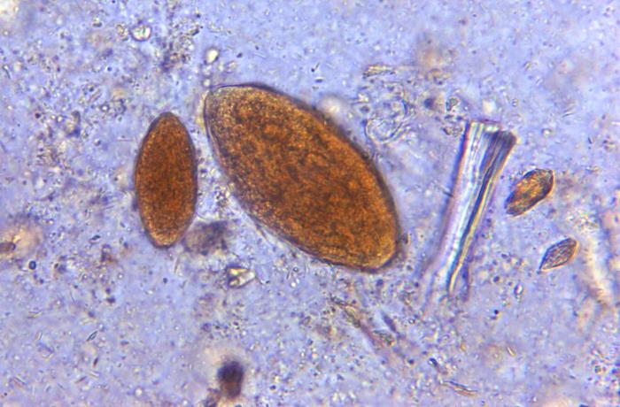 Huevos del género Fasciola. CDC Public Health Image Library (PHIL)                     